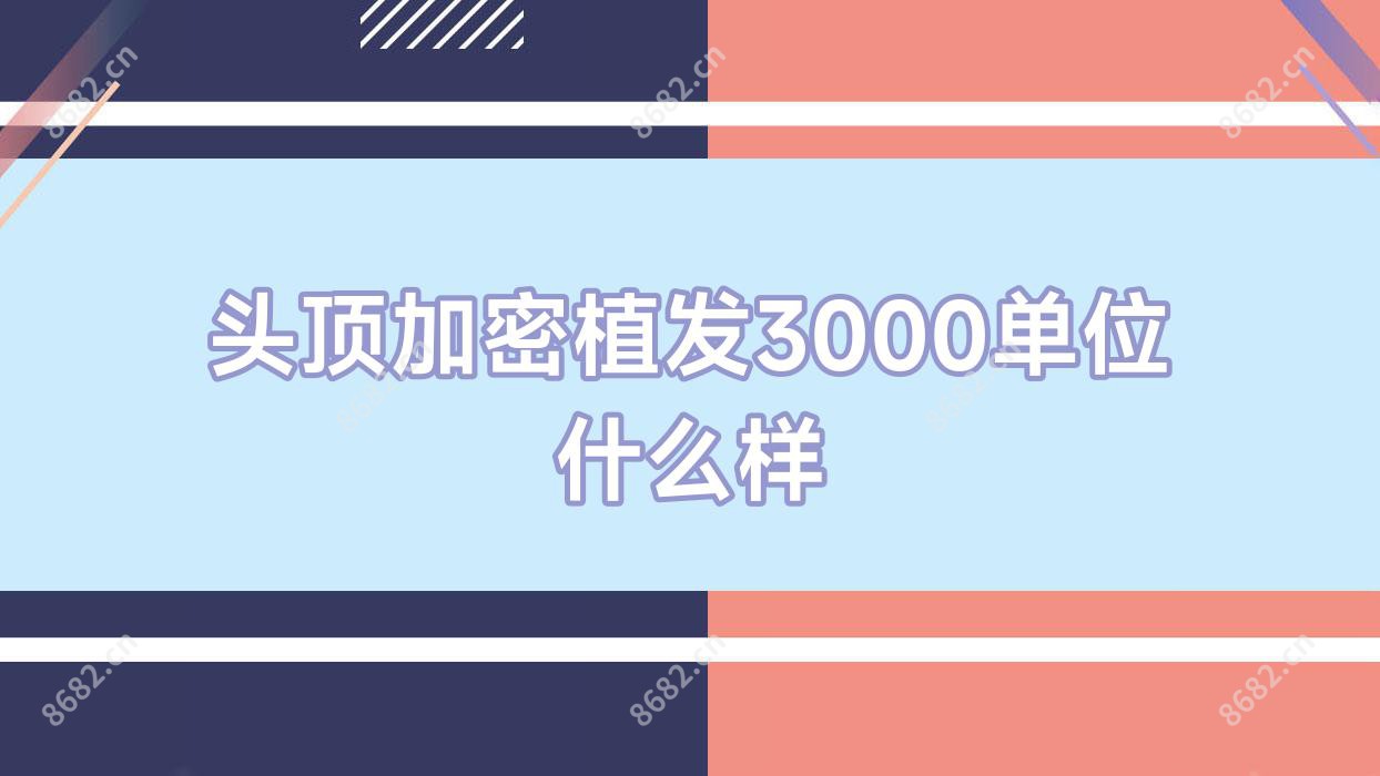 头顶加密植发3000单位什么样