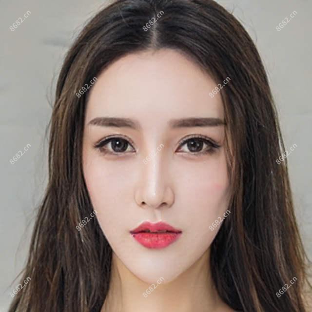 昆明垫下巴价格表一览,想变好看的朋友能够参考