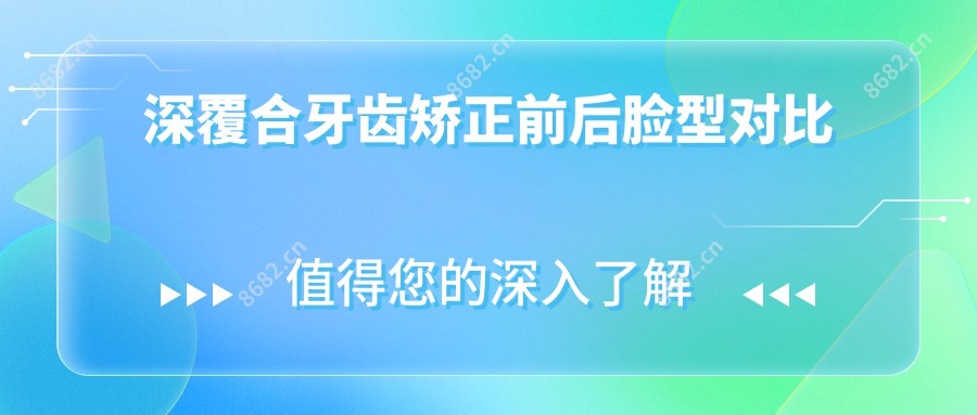深覆合牙齿矫正前后脸型对比