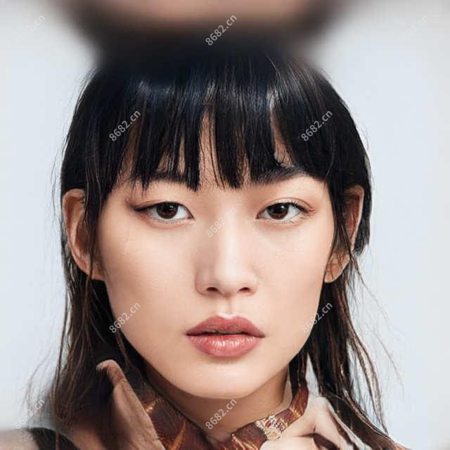 哈尔滨fue植发正规费用明细2025新版,哈尔滨fue植发/无痕植发多少钱
