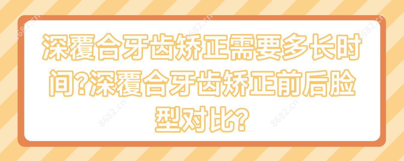 深覆合牙齿矫正需要多长时间?深覆合牙齿矫正前后脸型对比?
