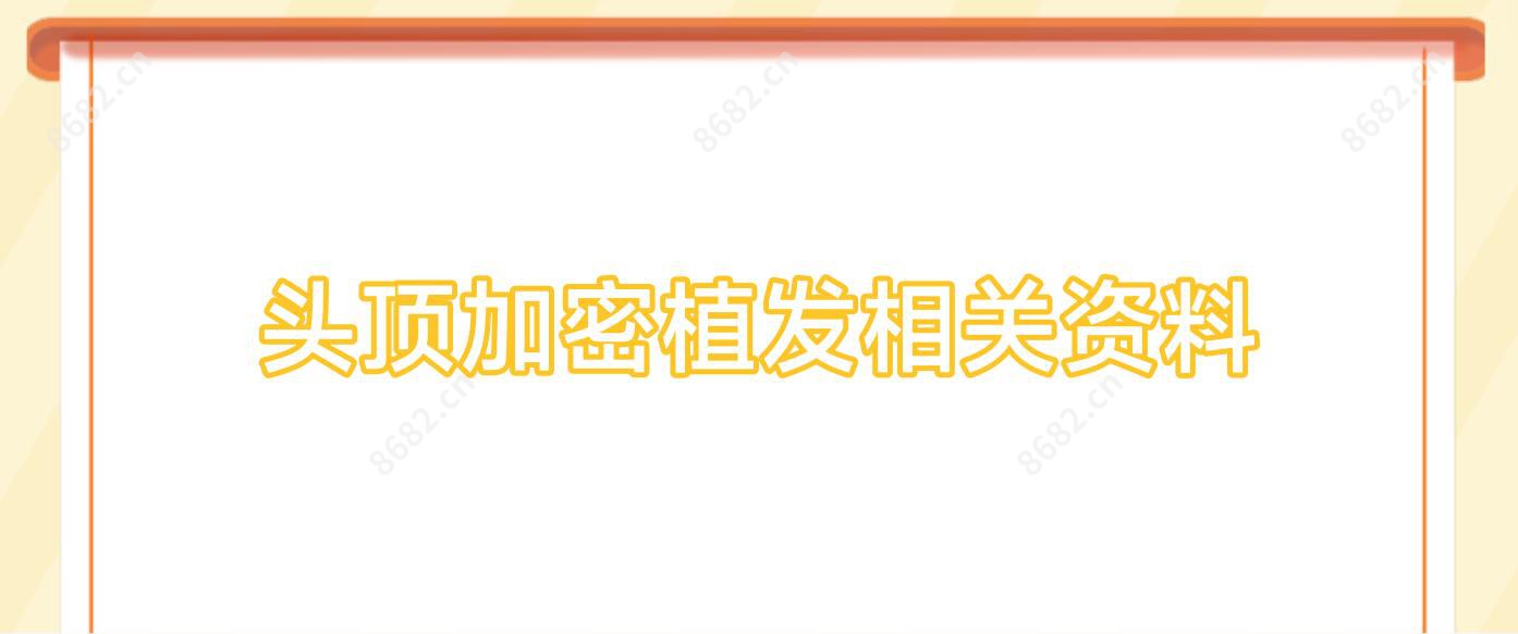 头顶加密植发相关资料