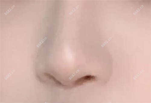 2025年大连多生牙价格及医院推荐排名10