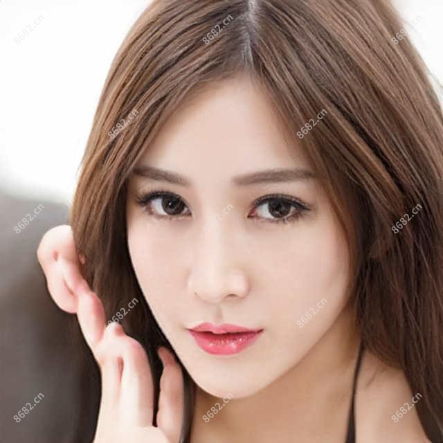 祛黑眼圈是什么,祛黑眼圈治疗方案推荐