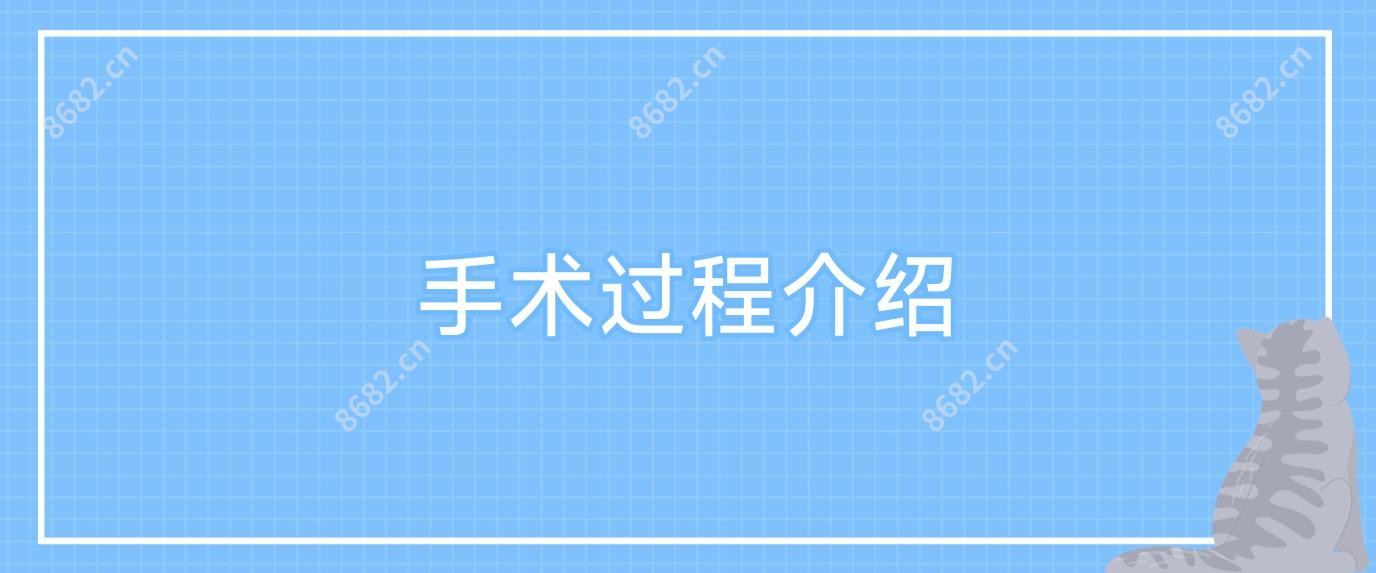 手术过程介绍