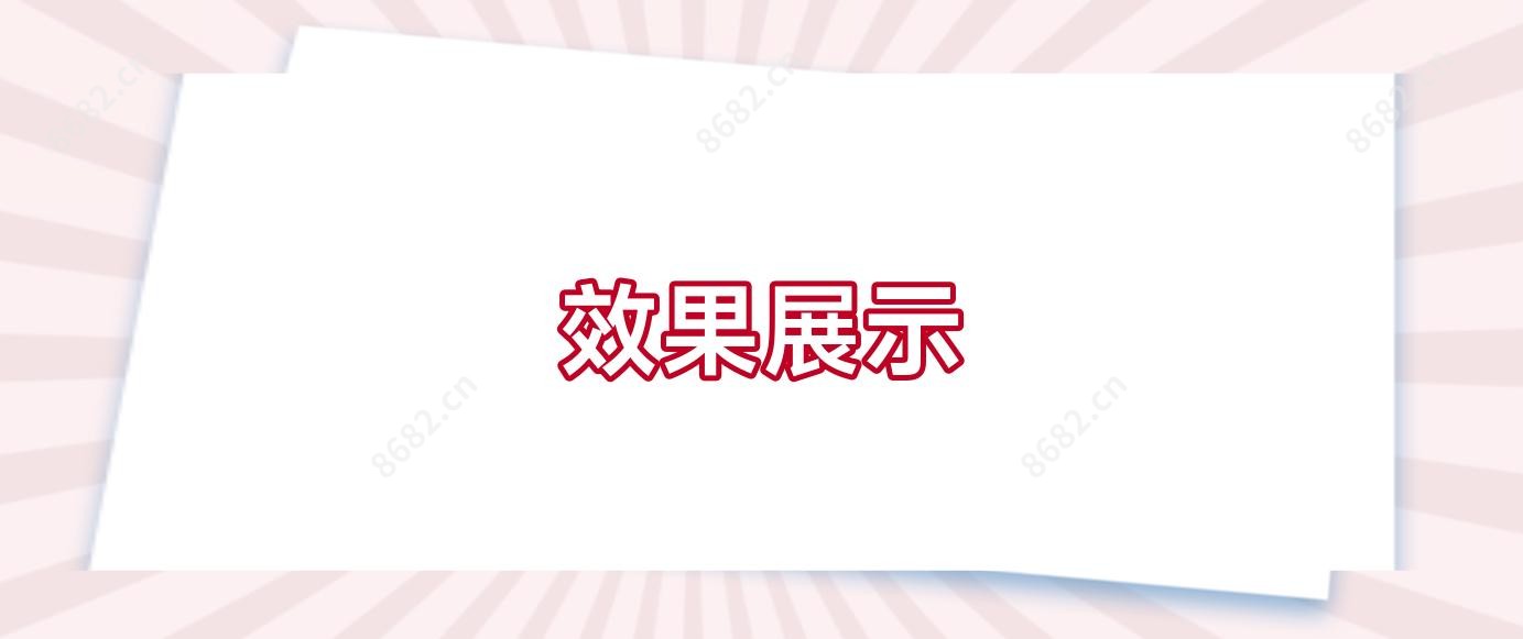 疗效展示