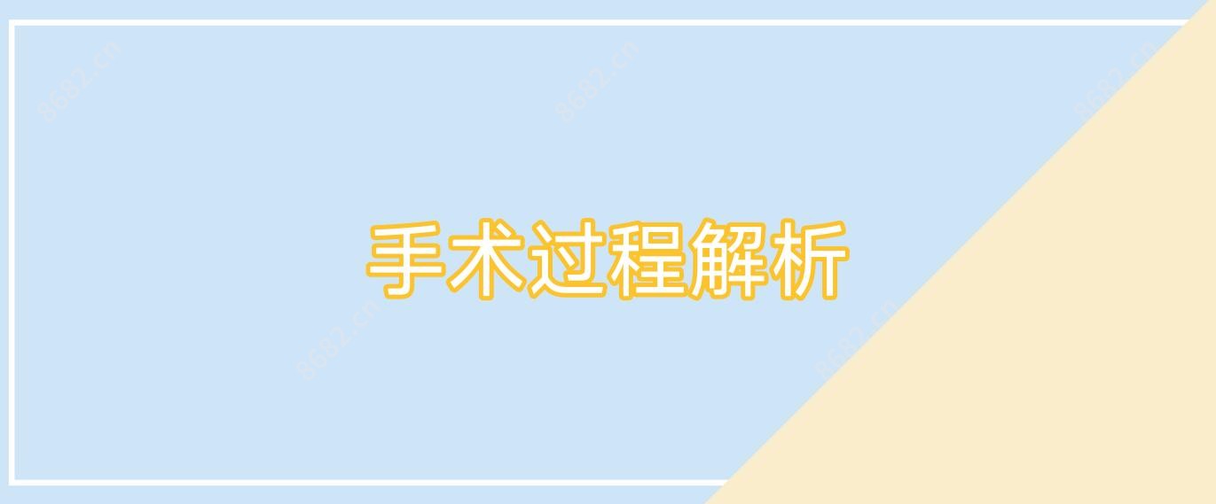 手术过程解析