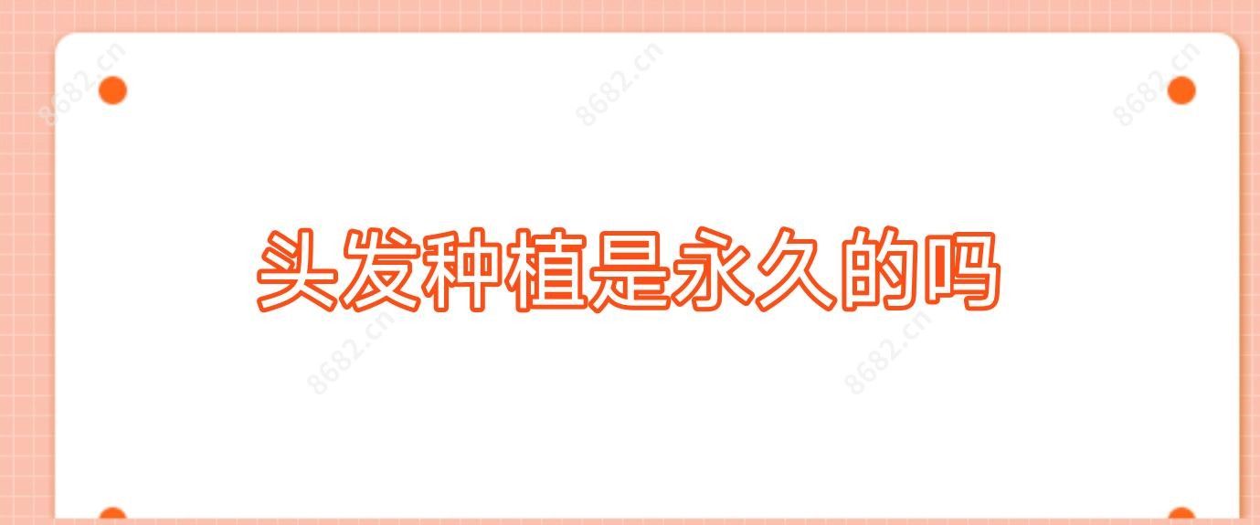 头发种植是持久的吗