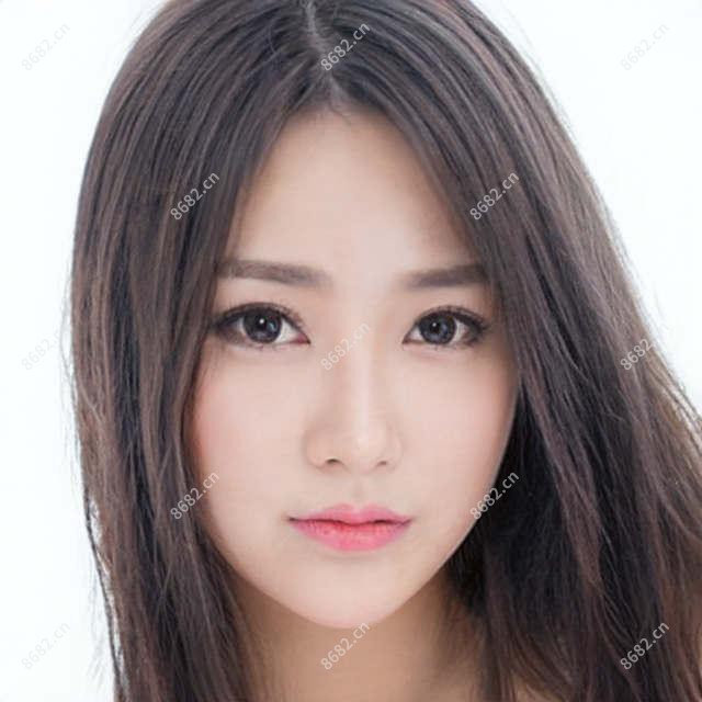 请问杭州玻尿酸去除鱼尾纹疗效怎么样？