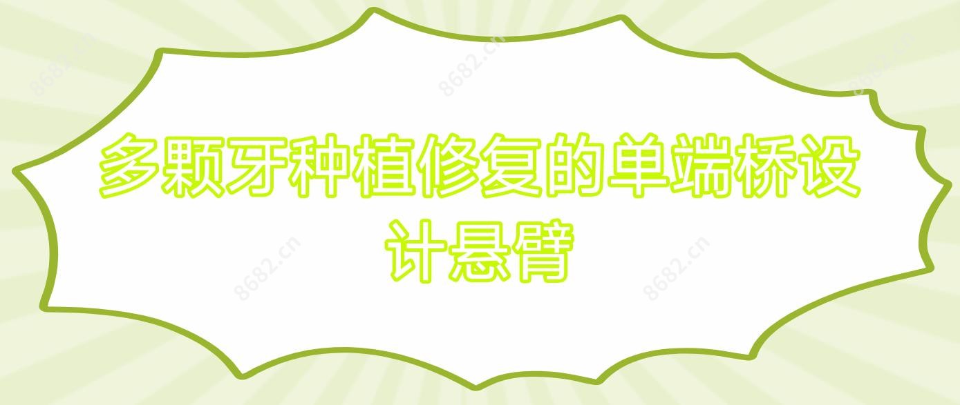 多颗牙种植修复的单端桥设计悬臂