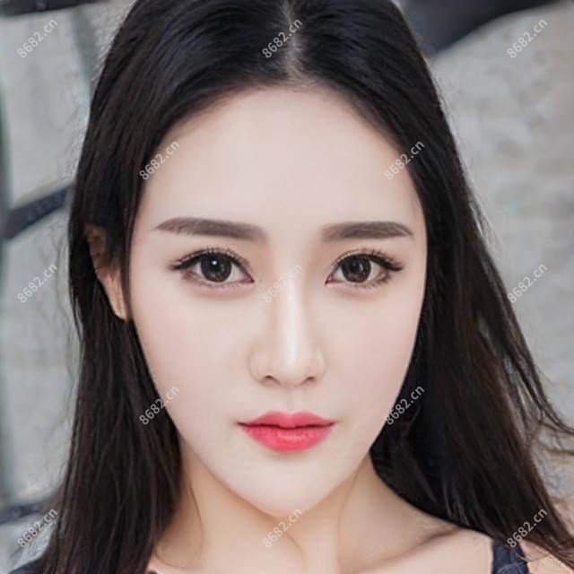 玻尿酸丰泪沟指南(玻尿酸丰泪沟治疗价格贵吗)