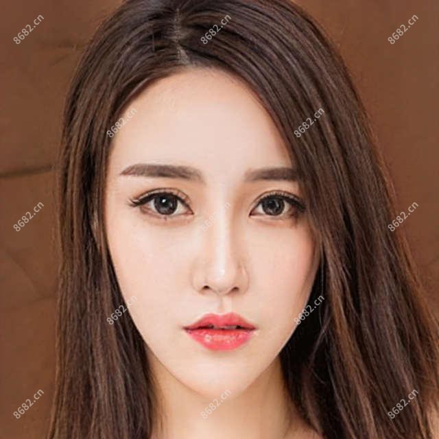 2025年贵阳allon6半口种植牙收费表:allon6半口种植牙57750+allon4半口种植牙4万+半口即刻负重种植牙5万+半口即刻种植牙10万+