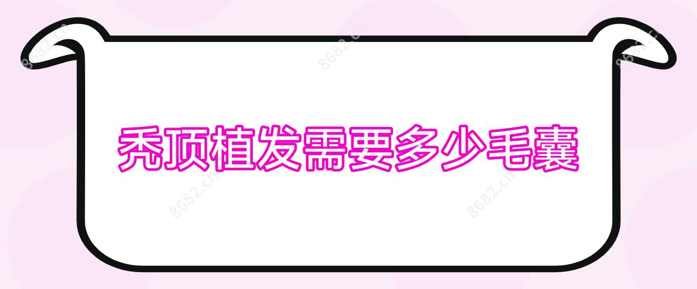 秃顶植发需要多少毛囊