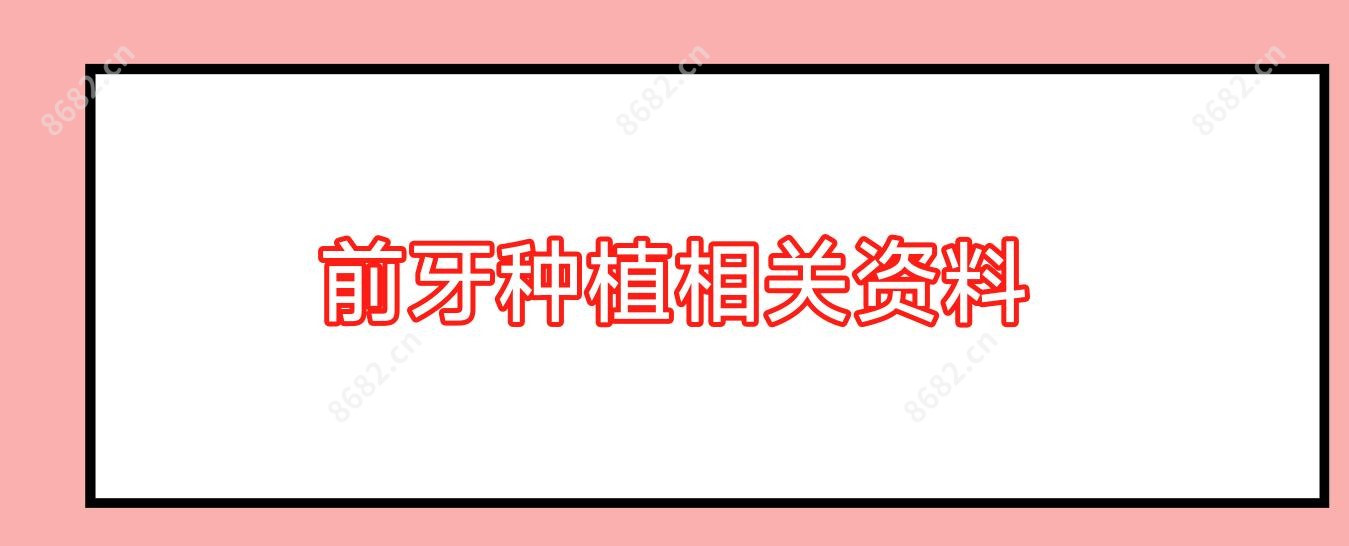 前牙种植相关资料