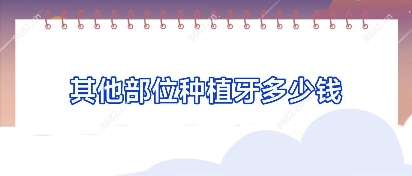 其他部位种植牙多少钱