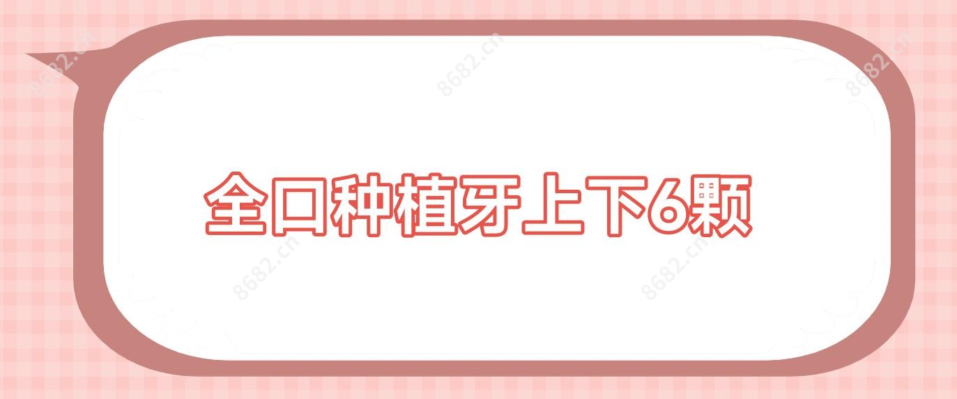 全口种植牙上下6颗