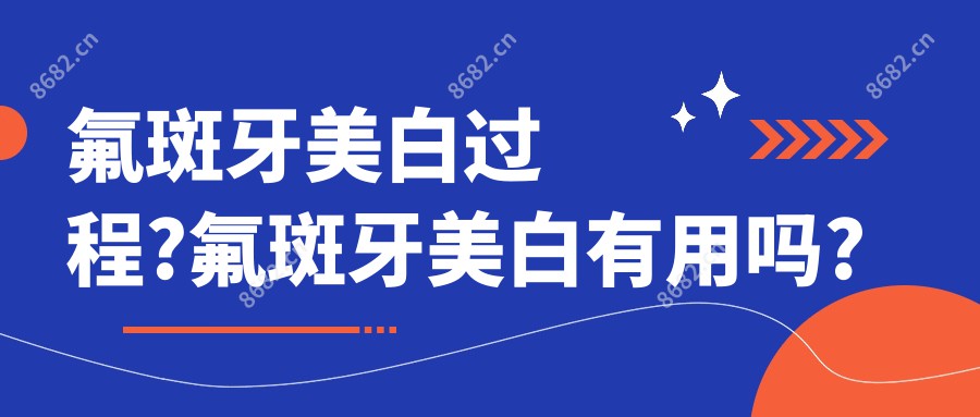 氟斑牙美白过程?氟斑牙美白有用吗?