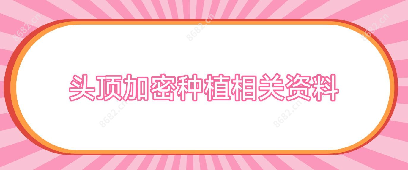 头顶加密种植相关资料