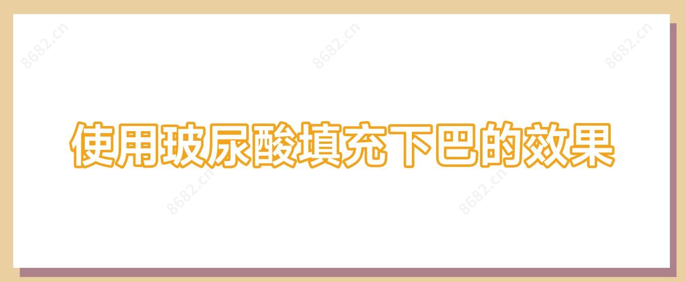 使用玻尿酸填充下巴的疗效