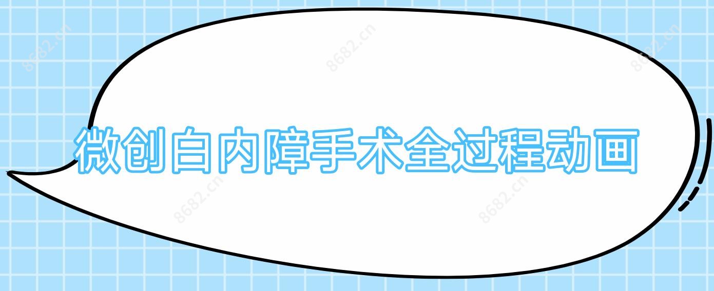 微创白内障手术全过程动画