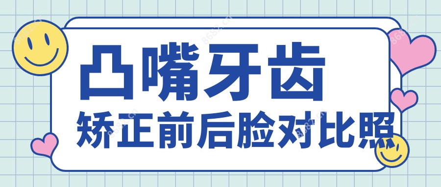 凸嘴牙齿矫正前后脸对比照