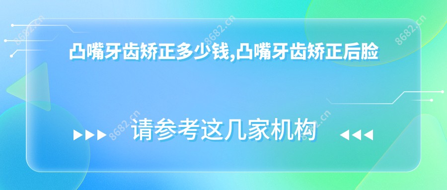 凸嘴牙齿矫正多少钱,凸嘴牙齿矫正后脸型会变好看吗