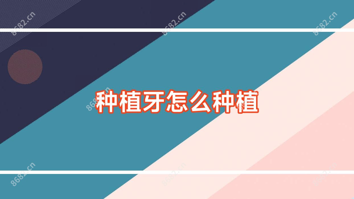 种植牙怎么种植