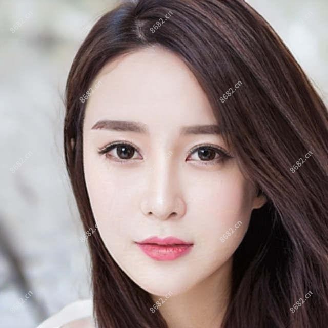 济南欧范双眼皮价格一览 | 双眼皮手术报价