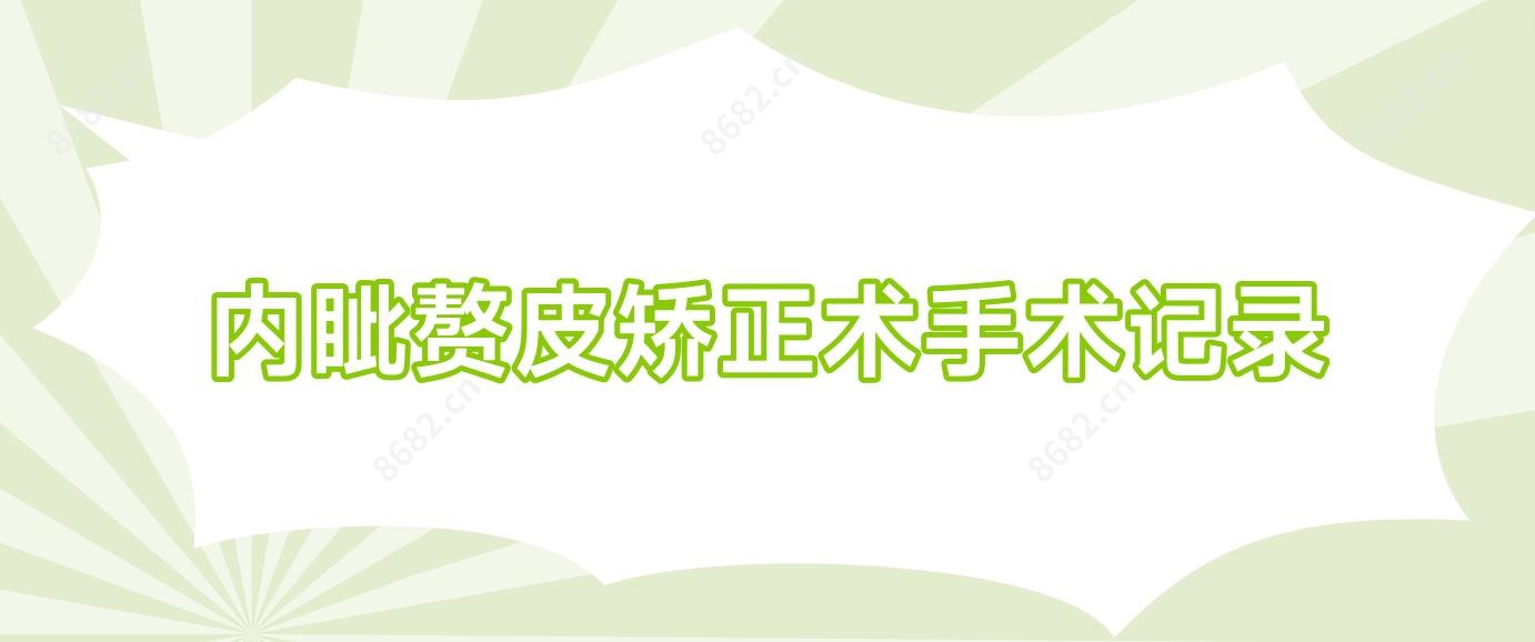 内眦赘皮矫正术手术记录