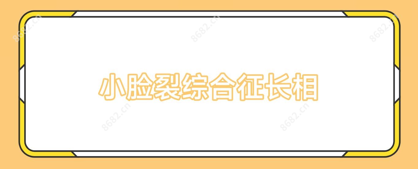 小脸裂综合征长相