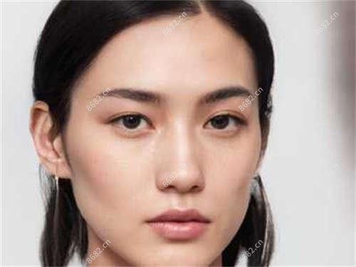 假体隆胸分析?假体隆胸好转方法详解?