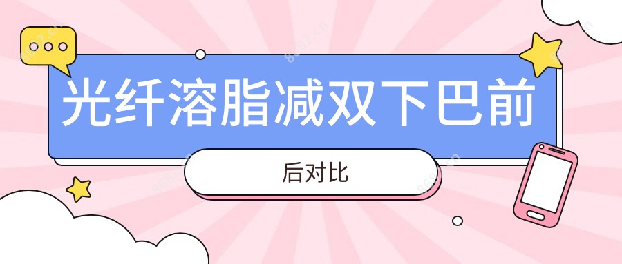 光纤溶脂减双下巴前后对比