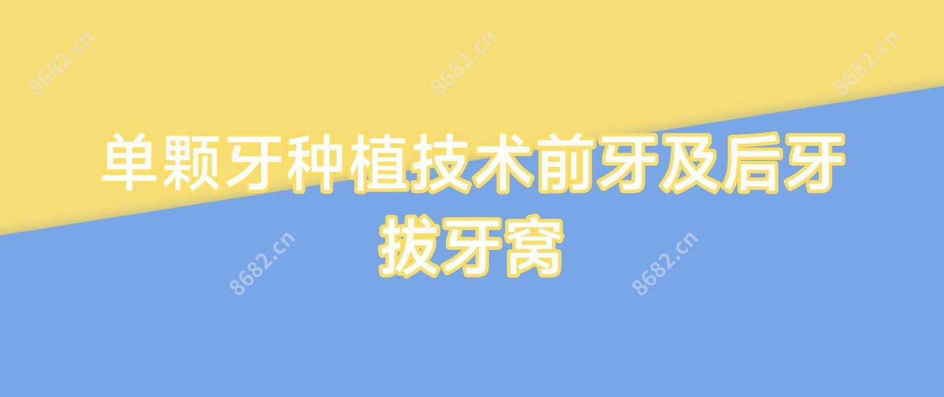 单颗牙种植技术前牙及后牙拔牙窝