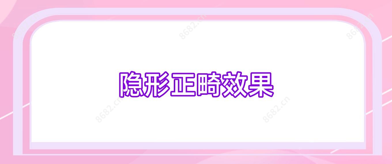 隐形正畸疗效