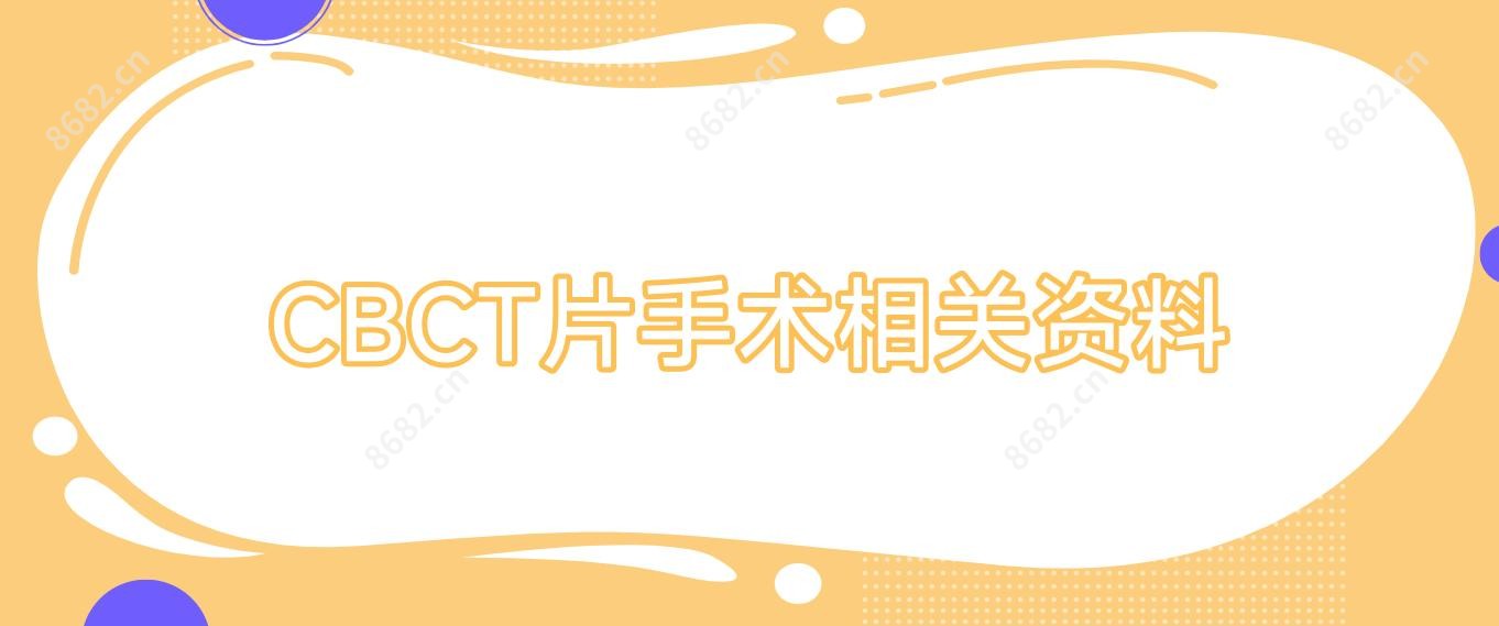 CBCT片手术相关资料