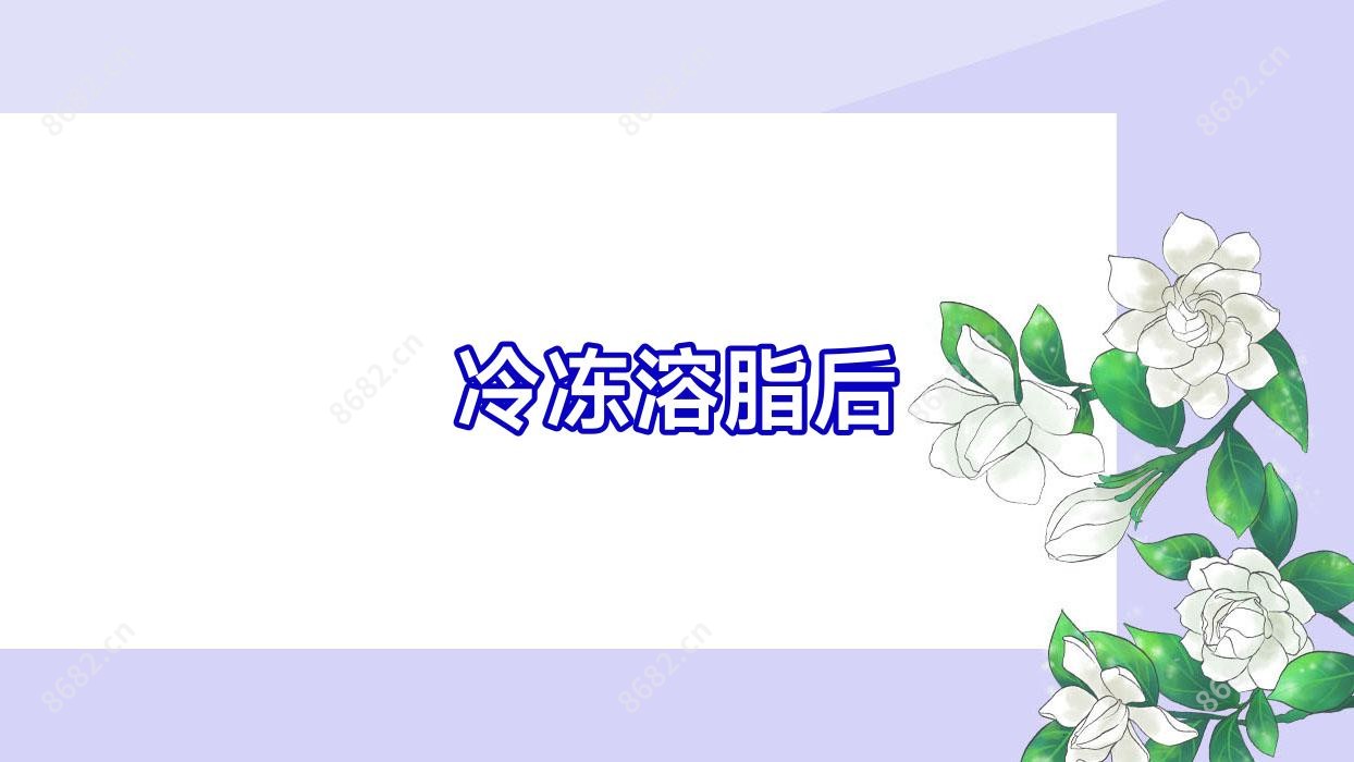 冷冻溶脂后