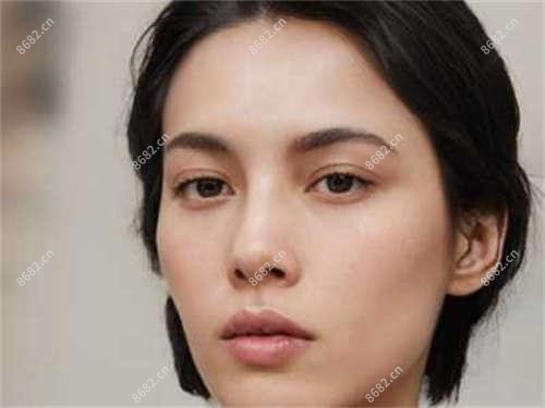2. 热玛吉的适用人群和疗效