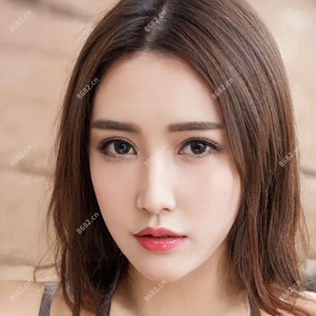 双眼皮整形需要注意什么?双眼皮整形治疗价格贵吗?