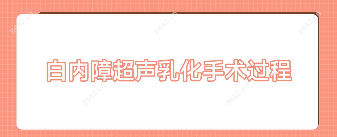 白内障超声乳化手术过程
