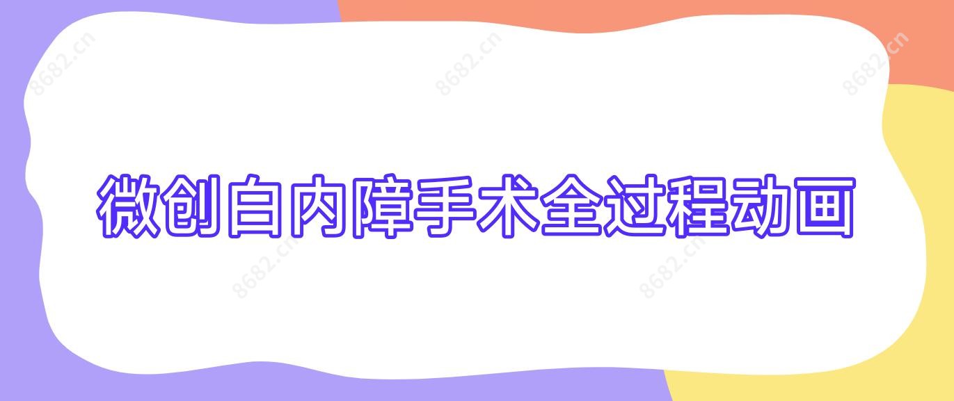 微创白内障手术全过程动画