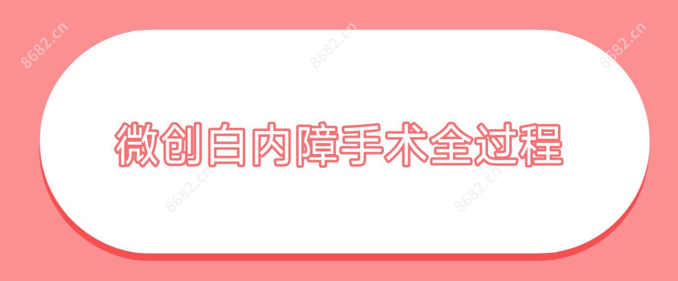 微创白内障手术全过程