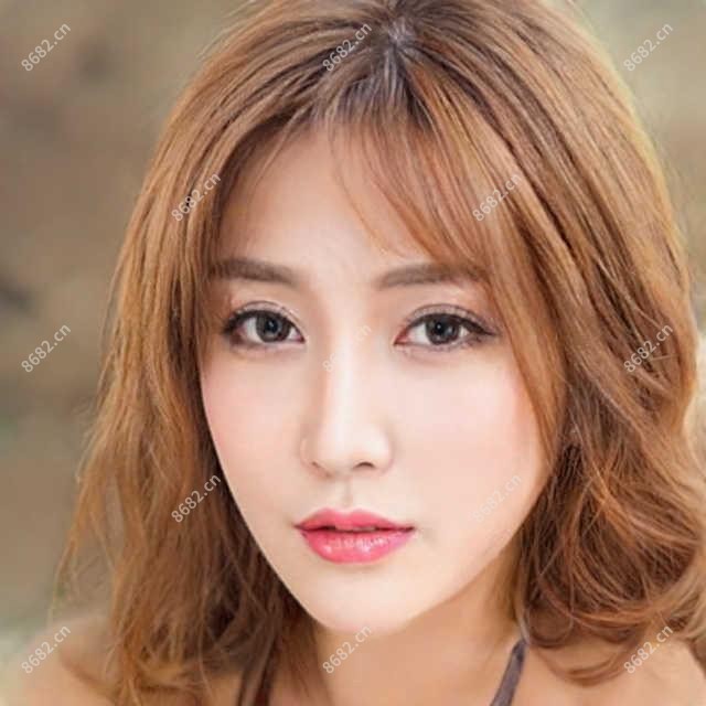 隐形矫正怎么办 隐形矫正相关治疗优缺点以及禁忌人群