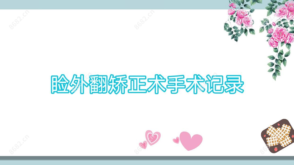 睑外翻矫正术手术记录