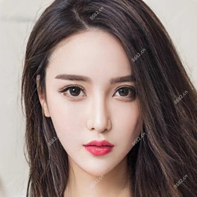 义眼怎么样?义眼好转方法详解?
