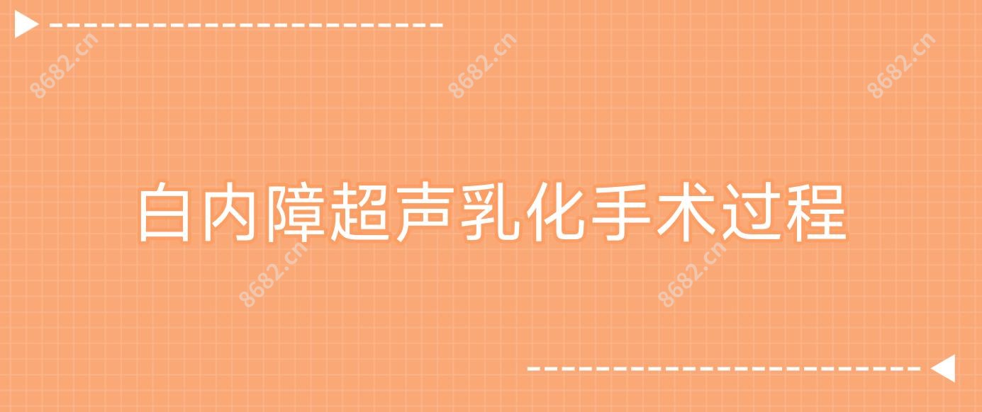 白内障超声乳化手术过程