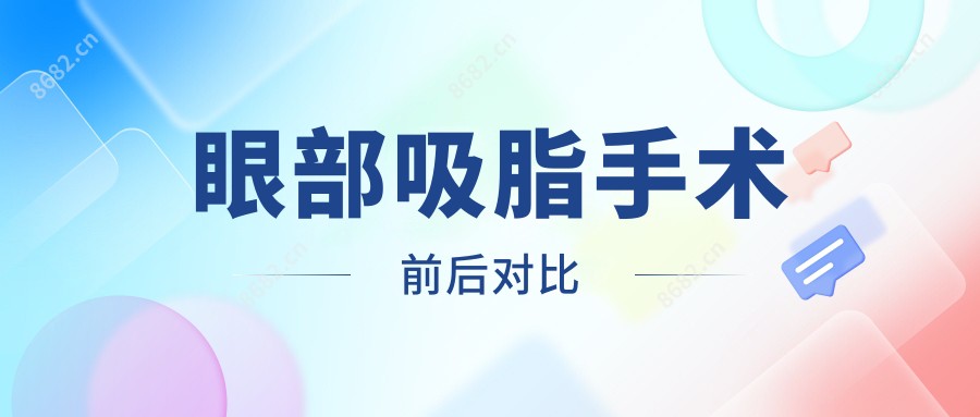 眼部吸脂手术前后对比