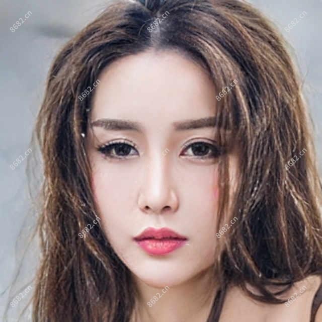 隆鼻手术有哪些风险?