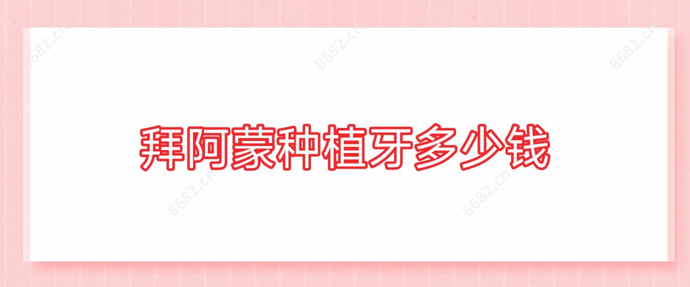 拜阿蒙种植牙多少钱