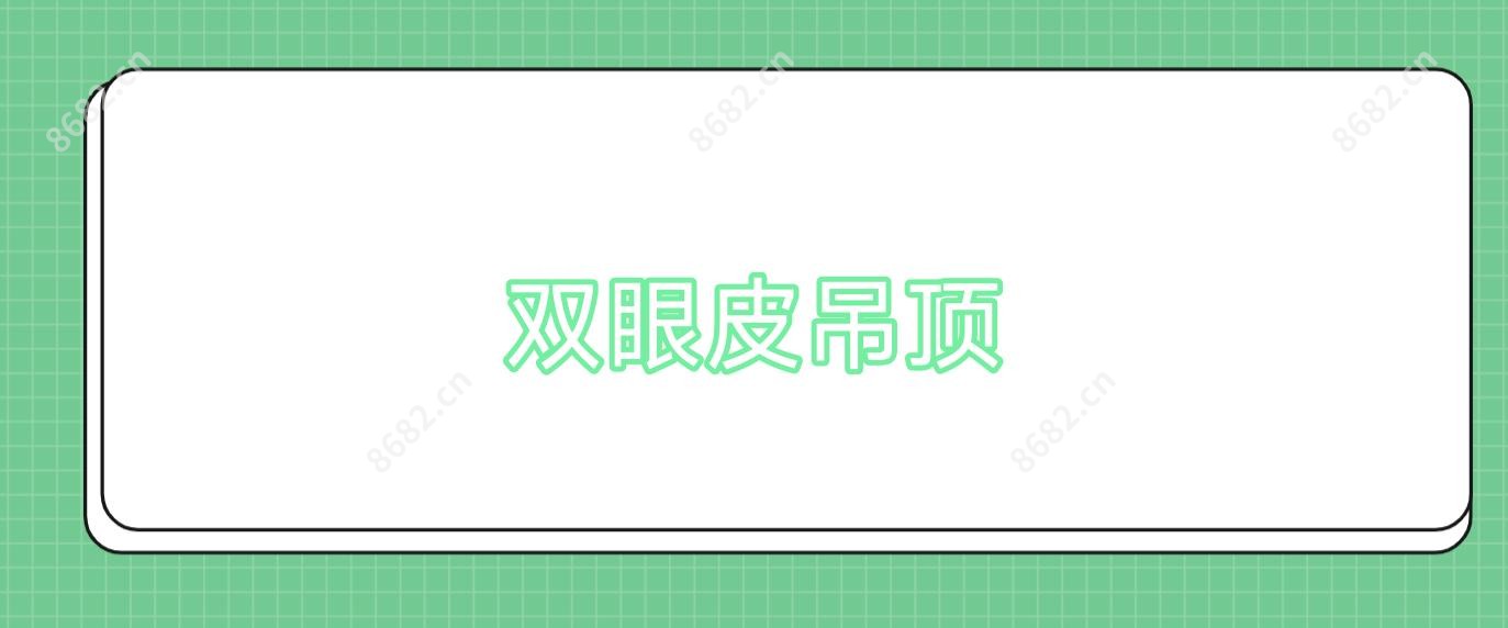 双眼皮吊顶