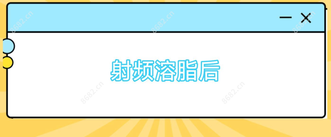 射频溶脂后